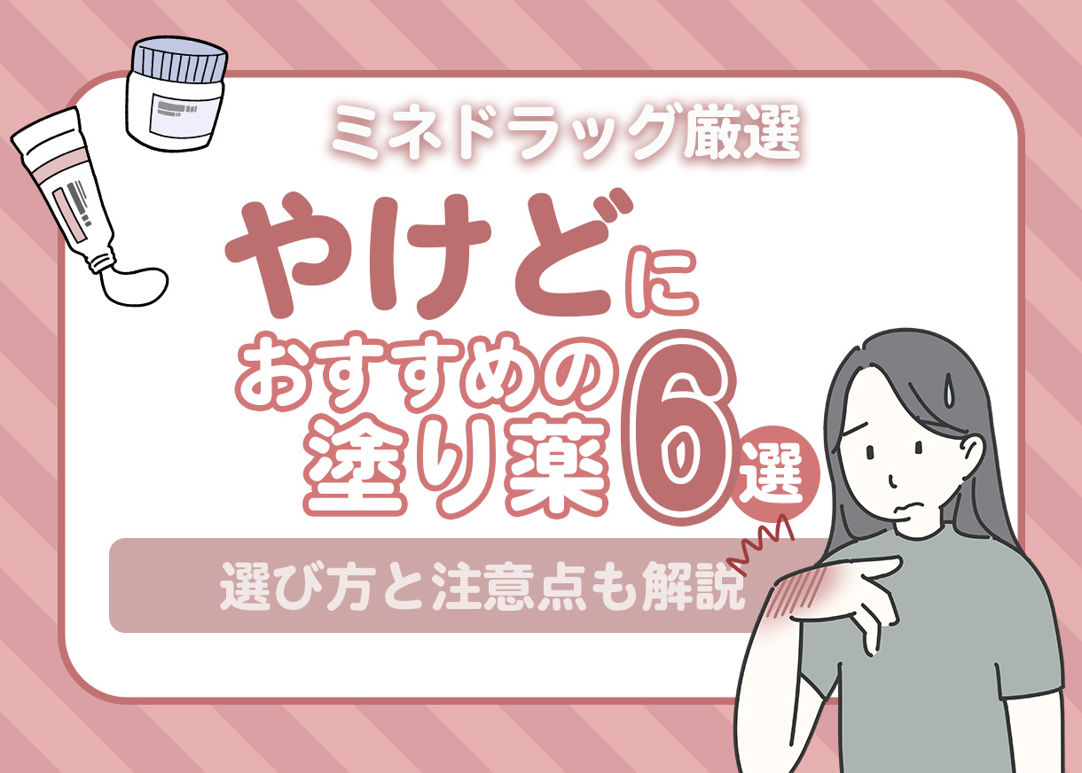 【薬剤師が監修】やけど（火傷）の時にすぐ使える！市販薬6選｜選び方・注意点も徹底解説！