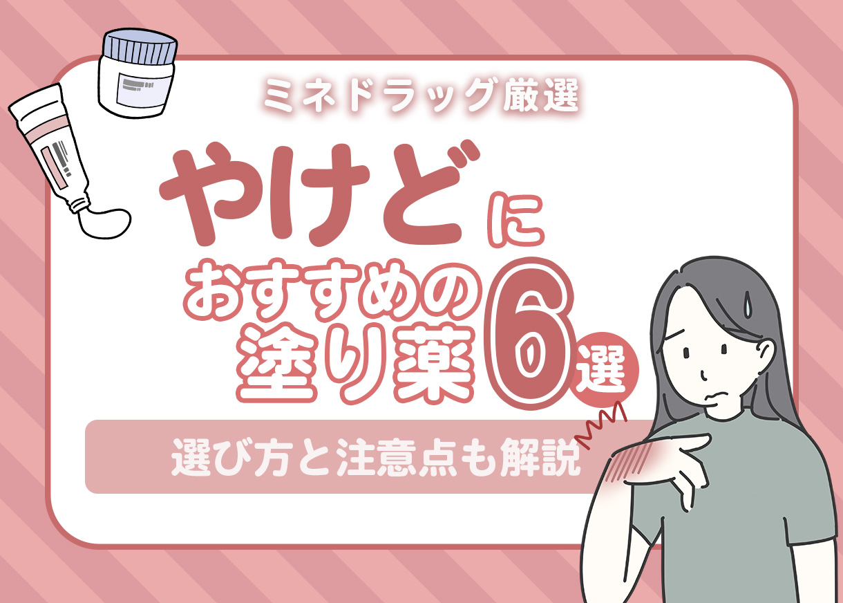 【薬剤師が厳選】やけど（火傷）の時にすぐ使える！市販薬6選｜選び方・注意点も徹底解説！